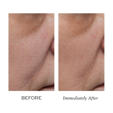 Peptide4 1000 Flower Mask